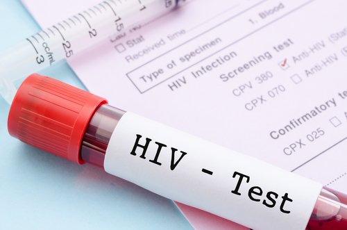 HIV_test_AIDS_Gam1983